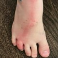 Sinu sam skinula čarapicu i videla crvenu liniju duž stopala, a onda sam uočila nešto što me je prestravilo (foto)