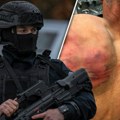 U poslednjih 15 dana osam osoba pretrpelo nasilje na Kosovu i Metohiji od tzv. policije: Da li je ovo poslednji alarm?