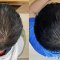 Najnoviji serum za rast kose pokazao neverovatan uspeh; šta je čudotvorni sastojak