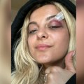 Albanska pevačica pokazala dvoglavog orla, pa napadnuta na koncertu: Posle incidenta usledila nova drama, sve je snimljeno…