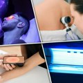 Šta koža "pamti“ posle sunca, mora i hlora: Ovi signali zahtevaju pregled kod dermatologa