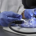 Prvi put u svetu: Kineski lekari uz pomoć AI ultrazvučnog robota izveli zahvat na srcu