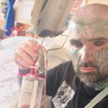 Tetovirao i beonjače, pa iznenada oslepeo: Lekari nemaju odgovor FOTO