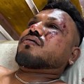 Čudo sa sedišta 11A: Ko je Višvakumar Rameš, jedini preživeli u avionskoj nesreći u Indiji?
