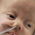 Mala Nikolija je izgubila borbu za život