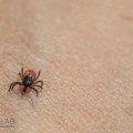 Сезона крпеља: Симптоми које не треба игнорисати