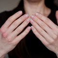 Nokti vam se lome i udubljuju?; Ovo može da bude znak nedostatka govožđa