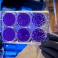 Naučnici razvili novi antibiotik protiv opasne bakterije koja muči bolnice