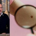 Koristeći "abcde" metodu spasite sebi život: Evo kako preduhitriti najsmrtonosniji rak - Možda godinama rizikujete svoje…