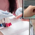 Nina iz Beograda dobila jezive pečate po telu od popularnog gel laka: "Svrab je nenormalan, kreme ne pomažu"