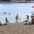 Ako izgorimo na Suncu, šta treba da znamo o opekotinama