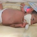 Rodila bliznakinje, ali sa pet nedelja razmaka: Starija je imala samo 450 grama kad se rodila a ceo svet je pratio njihovu…