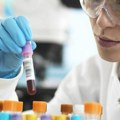 Medicina i Velika Britanija: Test krvi za 50 vrsta kancera ohrabrio naučnike