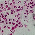 Opasna infekcija širi se Evropom: Polna bolest sve otpornija na antibiotike