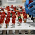 Britanski naučnici pripremaju vakcine za misterioznu "bolest Iks"