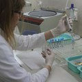 Prelomna tačka u borbi protiv raka? Naučnici razvili test koji otkriva opaku bolest i do tri godine pre pojave simptoma