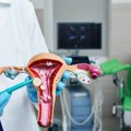 Nedostatak vitamina D povećava rizik od fibroida materice: Javljaju se kod 80 odsto žena do 50. godine