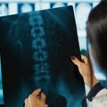 Najčešći problemi sa kičmom kod dece: Kako nastaju i kada se pojavljuju