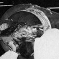(Video) Zamrznut 1967. godine: Evo kako je izgledalo telo Džejmsa Bedforda, prvog zamrznutog čoveka nakon 24 godine