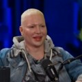 Bio je opasan frajer, SAD se izdeformisao operacijama! Evo čime se sada bavi Brendon: "Živim u svom..." (foto)