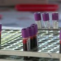 Razvijena nova metoda za dijagnostikovanje bolesti materice pomoću analiza krvi