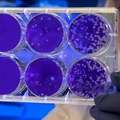 Proglašena epidemija leptospiroze u Sarajevu: Deratizacija izostala dve godine