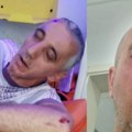 Zastrašujuće fotografije: Brutalno pretučen funkcioner SNS - Glava mu krvava