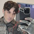 Poznati pevač zadobio blaži potres mozga nakon što ga je fan na koncertu pogodio telefonom u glavu