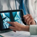 Osteoporoza – kako je prepoznati i koji faktori povećavaju rizik