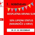 JUGOLAB 1. ROĐENDAN: BESPLATNA KRVNA SLIKA I 50% NA MASNOĆE