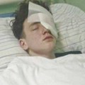 Martin (15) ostao bez oka i prstiju zbog petarde! "Nisam čuo ništa, onda su počeli da viču 'Nemaš palac'!"