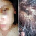 Osuđen siledžija iz Berana za stravično prebijanje devojke! Tukao je Dejanu i dok je ležala bez svesti, ona nakon presude…