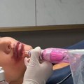 Anđela zgrozila javnost, šta joj se desilo sa licem? Ovjavila video, pa je urnisali u komentarima