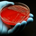 Zdravlje: Da li se antibioticima uništavaju i neophodne bakterije u ljudskim crevima