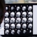 Veštačka inteligencija nudi revoluciju u dijagnostici kancera