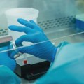 Трећи смртни случај од грознице Западног Нила у Северној Македонији