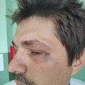 SNS aktivisti tuku opoziciju po Kosjeriću, država ne reaguje