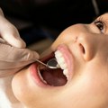 "Gas smejavac" prvi put primenjen na stomatologiji VMA: Inhalaciona sedacija smanjuje napetost i nelagodnost, pacijent sve…