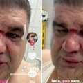 Saša Mirković se oglasio posle brutalnog prebijanja u Zagrebu: Niko iz hotela nije izašao (VIDEO)