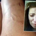 Ožiljci na nogama, modrice na glavi: Ana Nikolić je u paklu sa Raletom: "Zatvorio mi je oko", on tvrdi: "Dužna mi je 40.000…