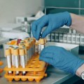 Proverite zdravlje – testiranje na HIV i hepatitis je brzo i besplatno, a eventualno lečenje uspešno i komforno