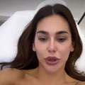 Naša fatalna pevačica (37) bez trunke šminke Nikad je ne viđate ovakvu: Bockala se kod doktora, evo šta je radila na sebi