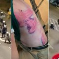 Akademske inicijative pitaju: Ko je naredio policijsko nasilje u Valjevu