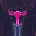 Suvoća vagine: Jeste problem, orošavanje nije rešenje