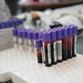 Institut pozvao dobrovoljne davaoce krvi i poručio Hvala za spasene živote