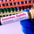Infekcija kojoj antibiotici ne pomažu: Prenosi se intimnim odnosima, a može da prođe bez simptoma
