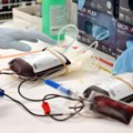 'Rezerve drastično smanjene': Zašto je važno redovno davanje krvi