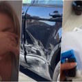 Modrice, podlivi, suze! Sofija Janićijević pokazala kako izgleda nakon saobraćajne nezgode