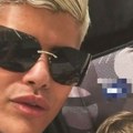Pokazao je rezultate nakon što je spao otok: Uroš povećao usne, mnogi ga prozvali "Moraš li to da uradiš"