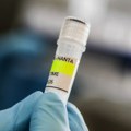 Španski putnik pozitivan na hantavirus stabilno - ostali u karantinu bez simptoma